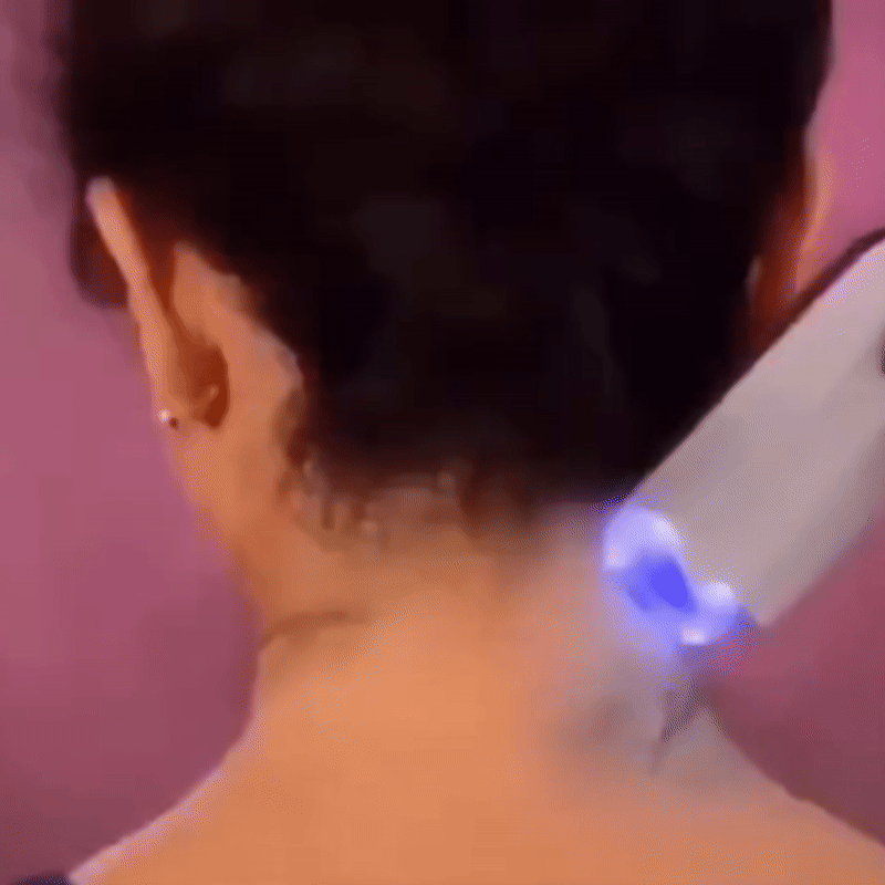 Aparat de Epilat Electric