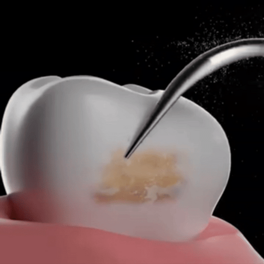 Aparat Pentru Curățarea Dinților