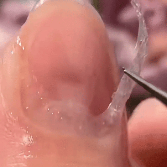Gel Profesional Indepartare Cuticule